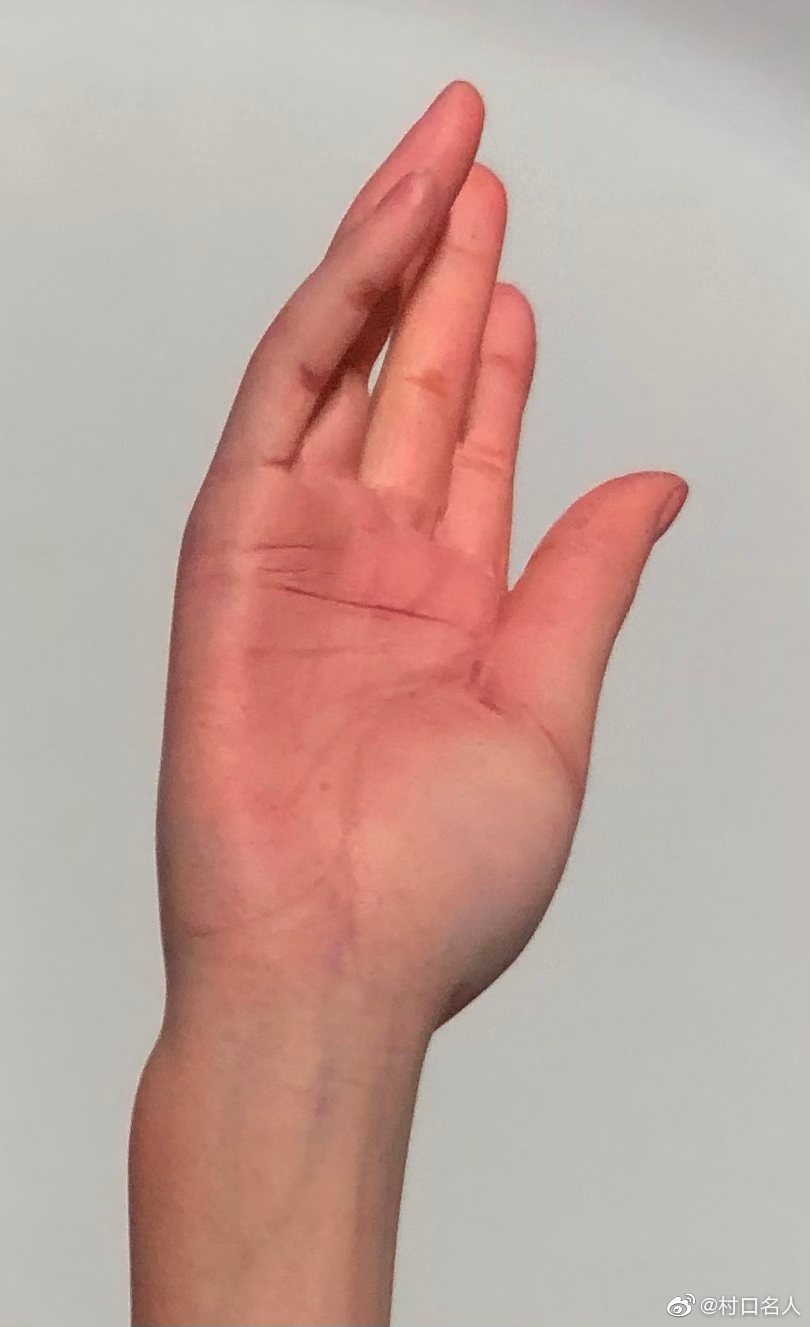 Ϊ