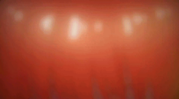 886
